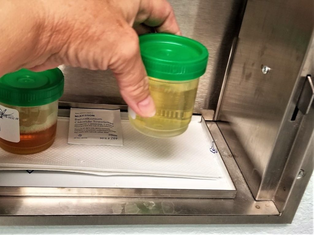 8 ways to keep pee warm for drugs test. What pill bottle temp fails?